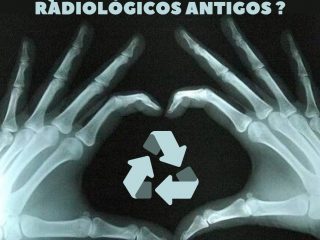Campanha de descarte de exames radiológicos